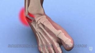 成人艾灸教学视频大全,成人艾灸入门与进阶指南