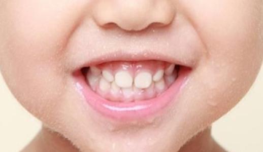 拔乳牙成人过程视频教程