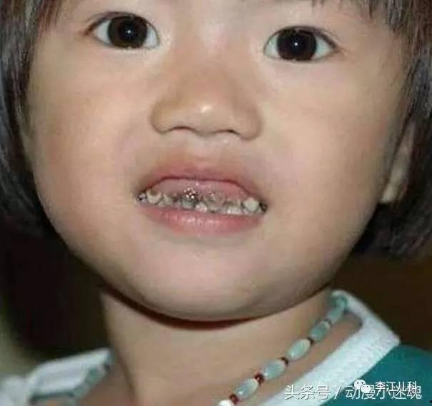 成人吃糖牙坏的视频,揭秘成人吃糖导致牙坏的真实案例