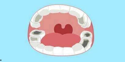 成人吃糖牙坏的视频,揭秘成人吃糖导致牙坏的真实案例